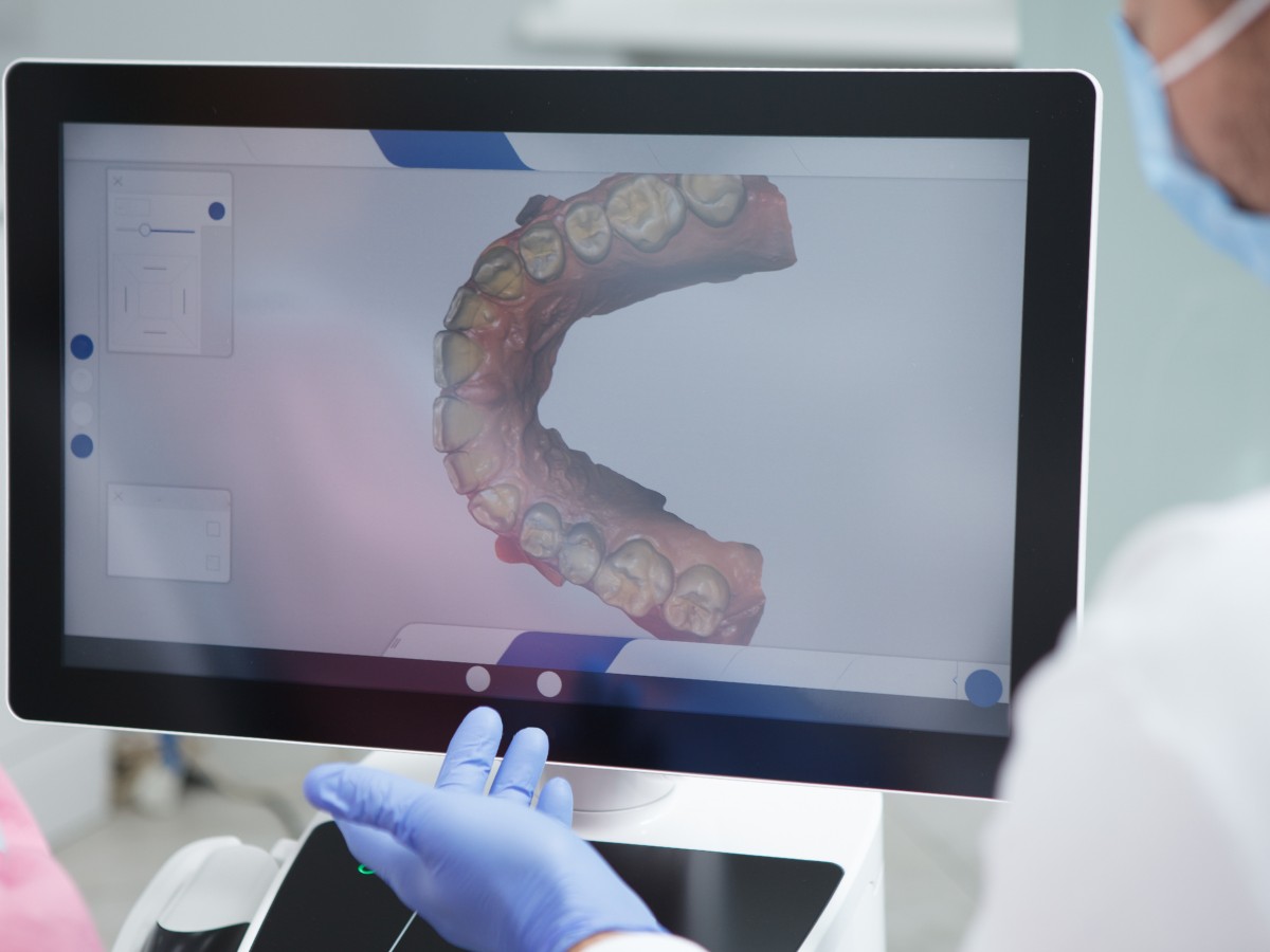 Escáner intraoral Tetuan Escáner Intraoral