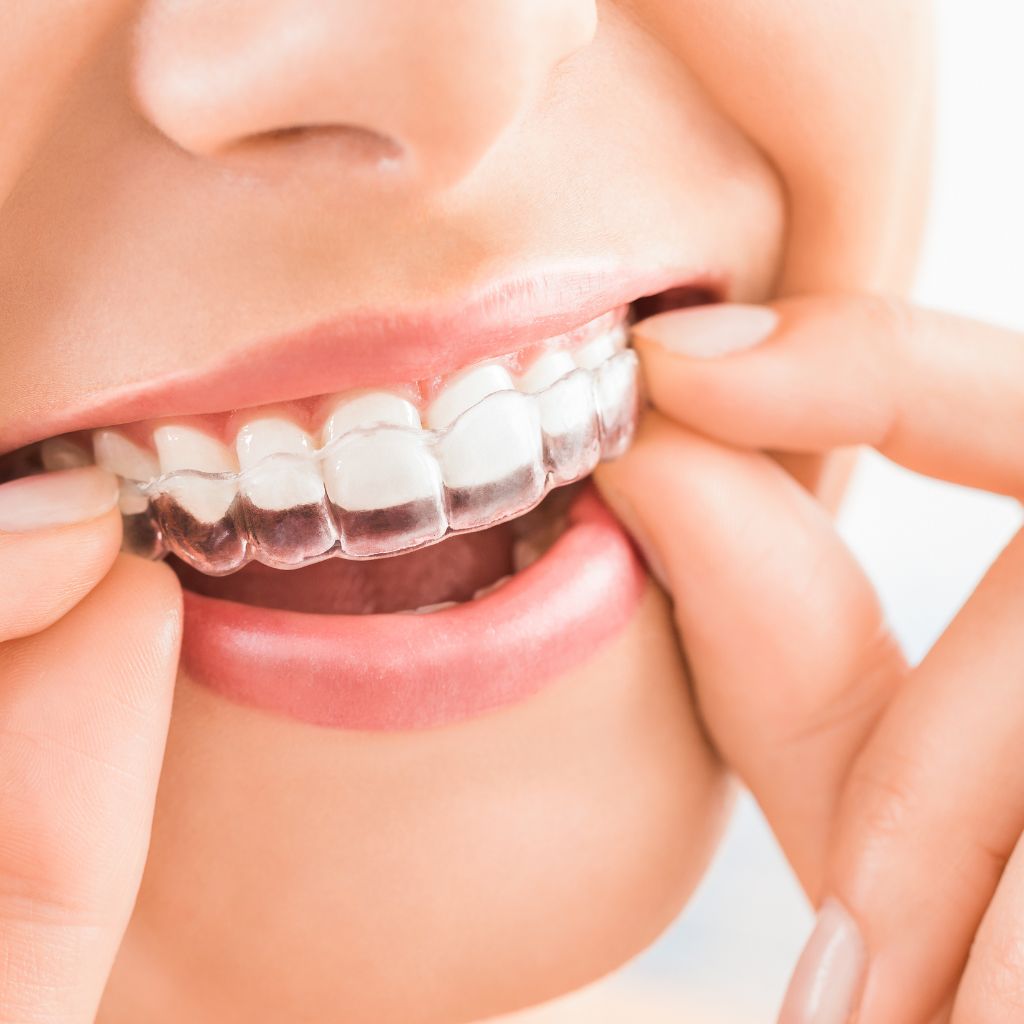 ortodoncia invisible madrid